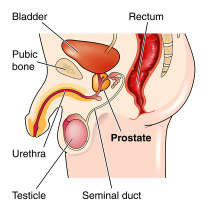 healthy prostate prostatitis sárgaréz